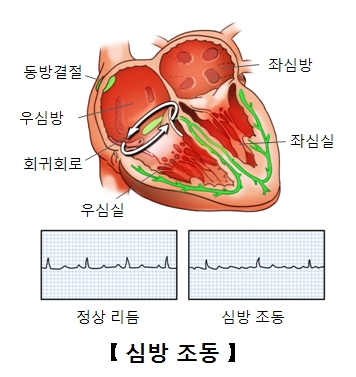 심방 조동