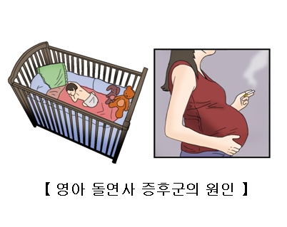 영아 돌연사 증후군