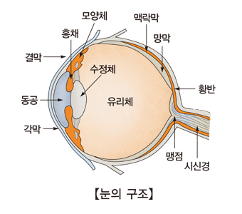 화농성 내안구염