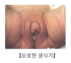 모호한 생식기