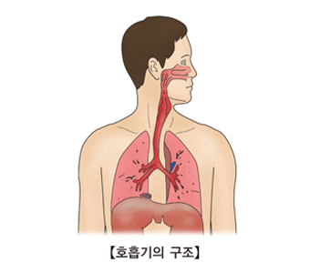 전이성 폐암