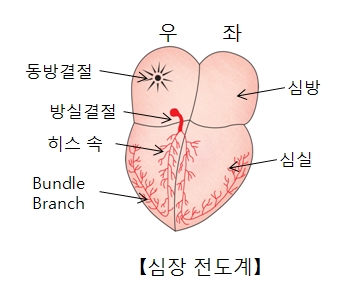 발작성상심실성빈맥