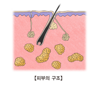 피부염