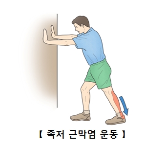 족저 근막염