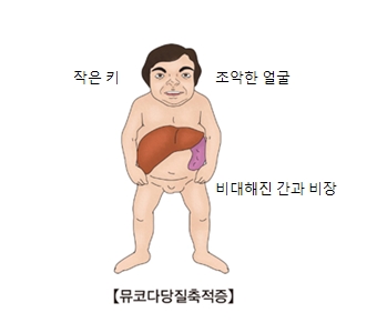 헐러 증후군