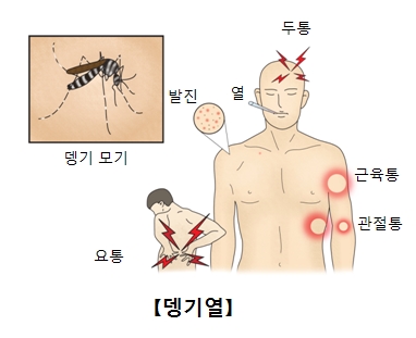 뎅기열