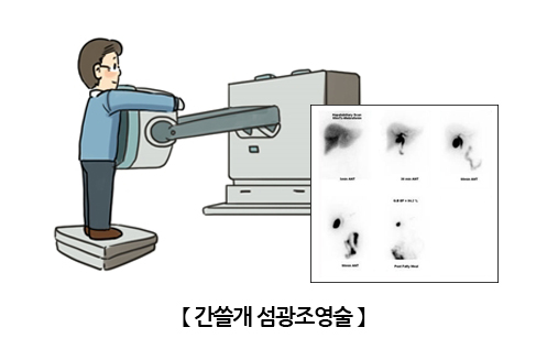 간쓸개 섬광조영술