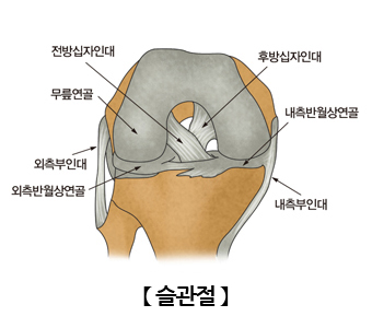 슬관절