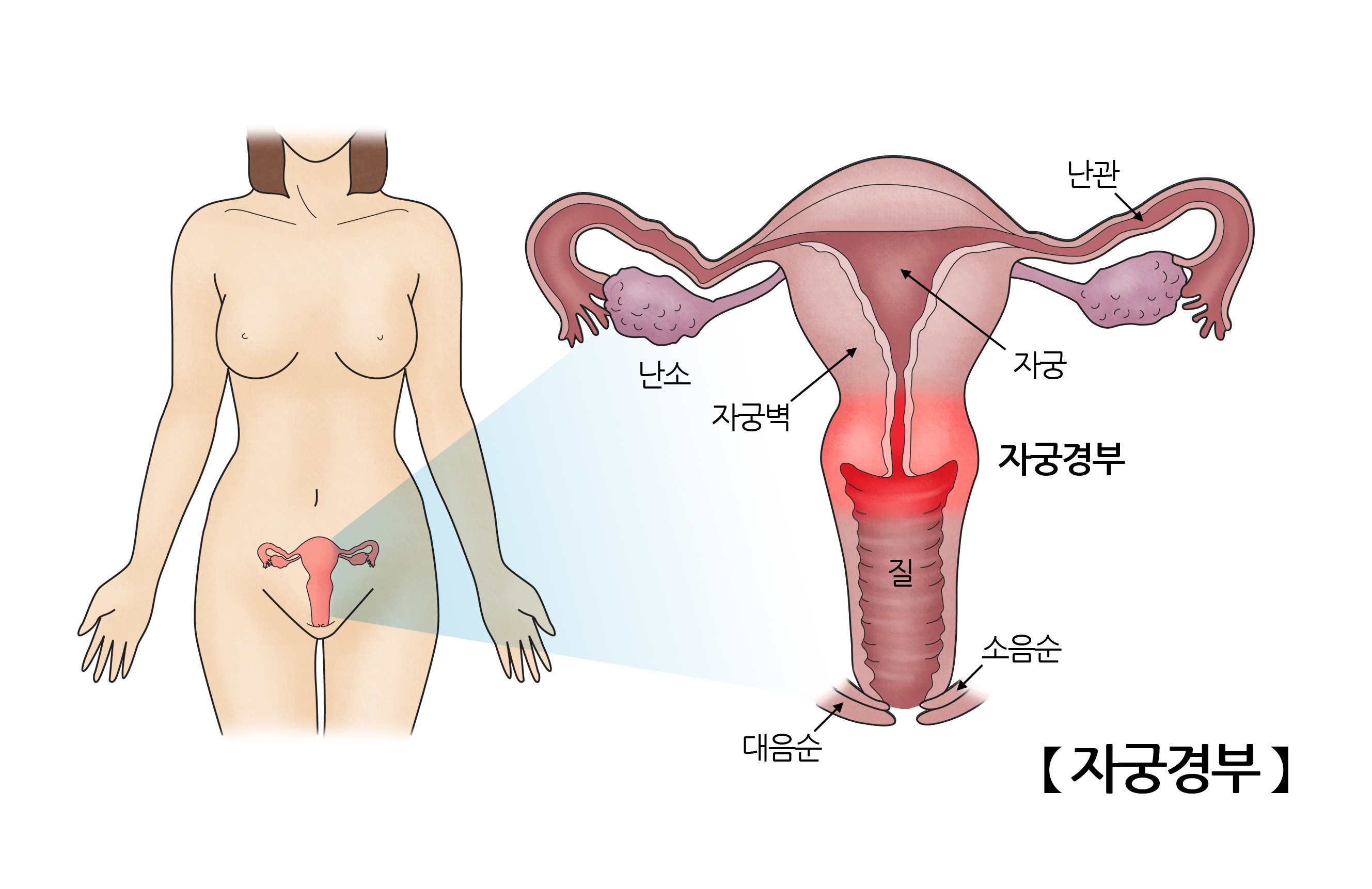 자궁경부